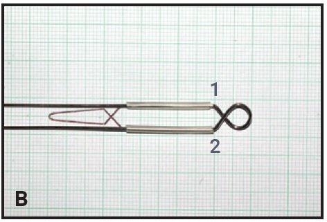 Treatment Auxillaries: Elastics (rubber bands) - Forbes Orthodontics