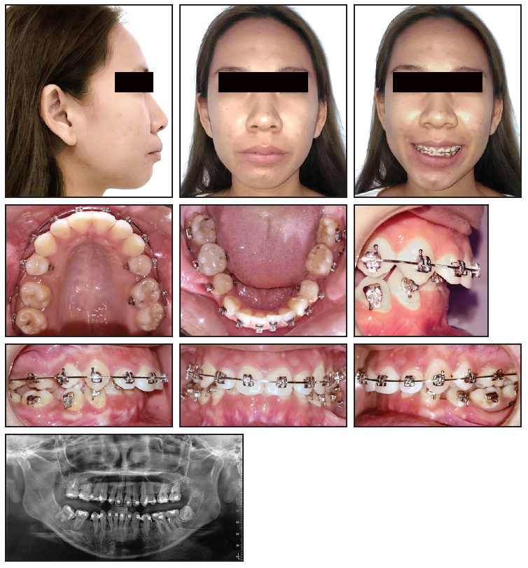 JCO Online - Journal of Clinical Orthodontics