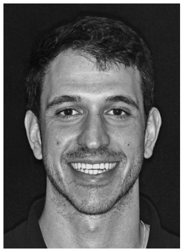 DR. MARIO PALONE DDS, MS