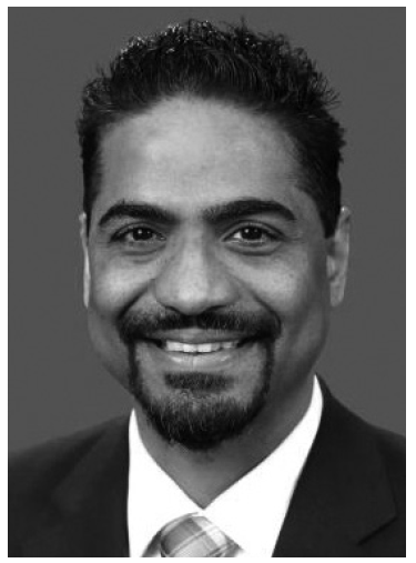 DR. AVINASH BIDRA DDS, MS