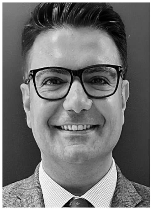 DR. SERCAN AKYALÇIN DDS, MS, PhD